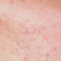 Rejuven8SkinClinic